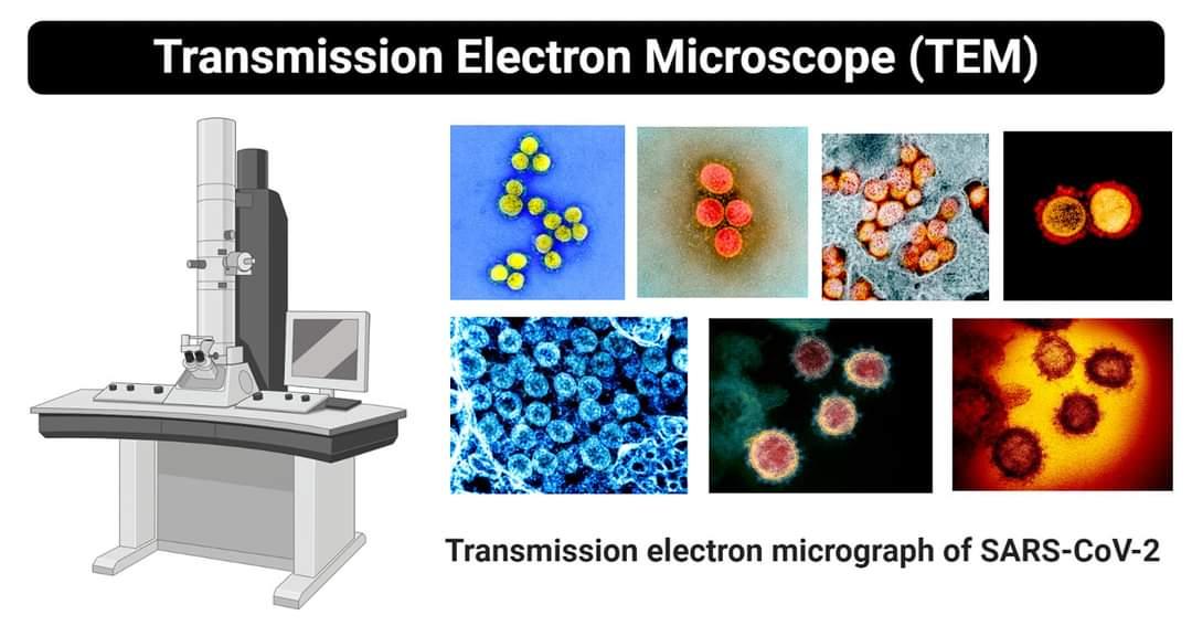 The Numerous Alterations During Sample Preparation for EM Imaging