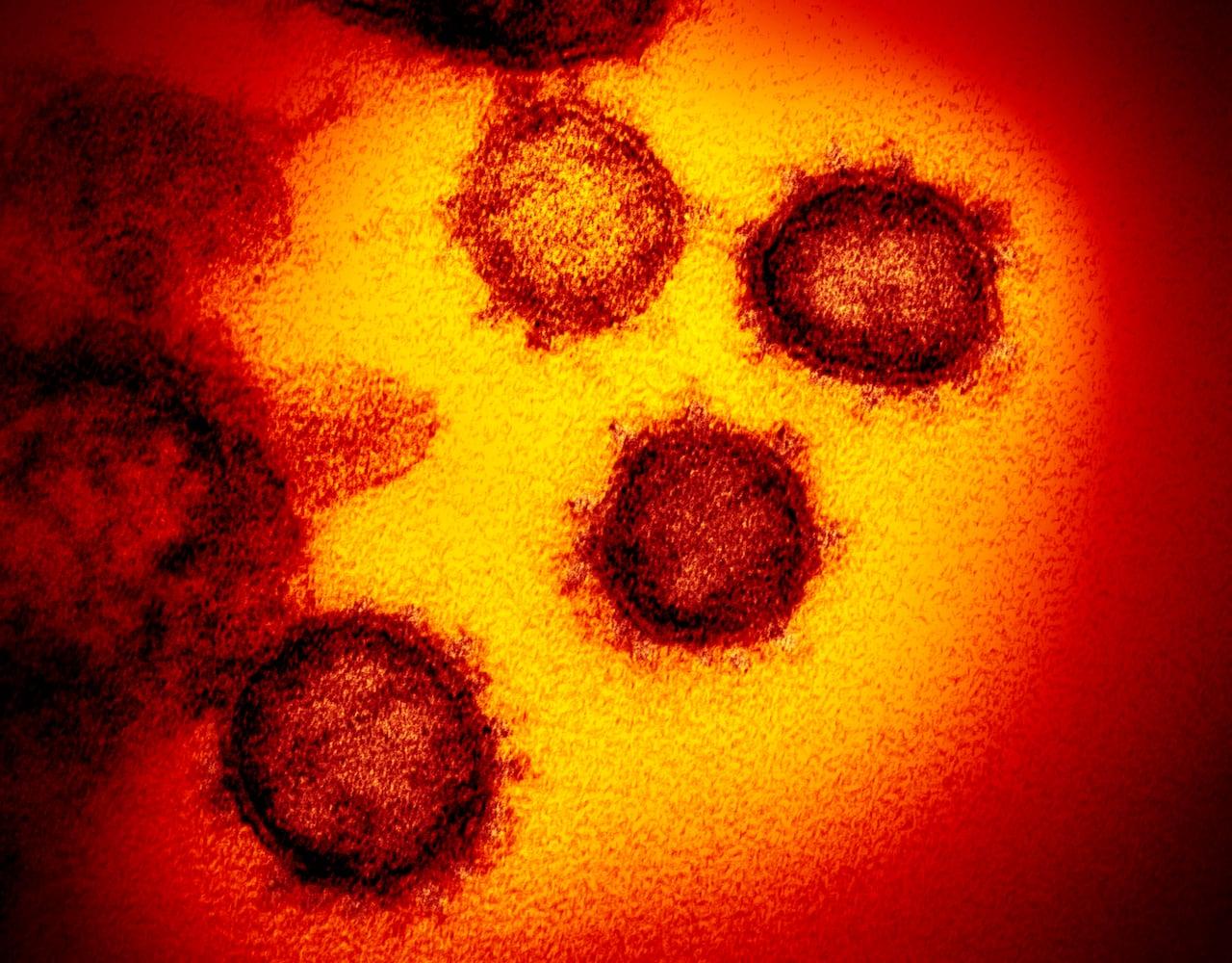 Creating the &#8220;Coronavirus&#8221;