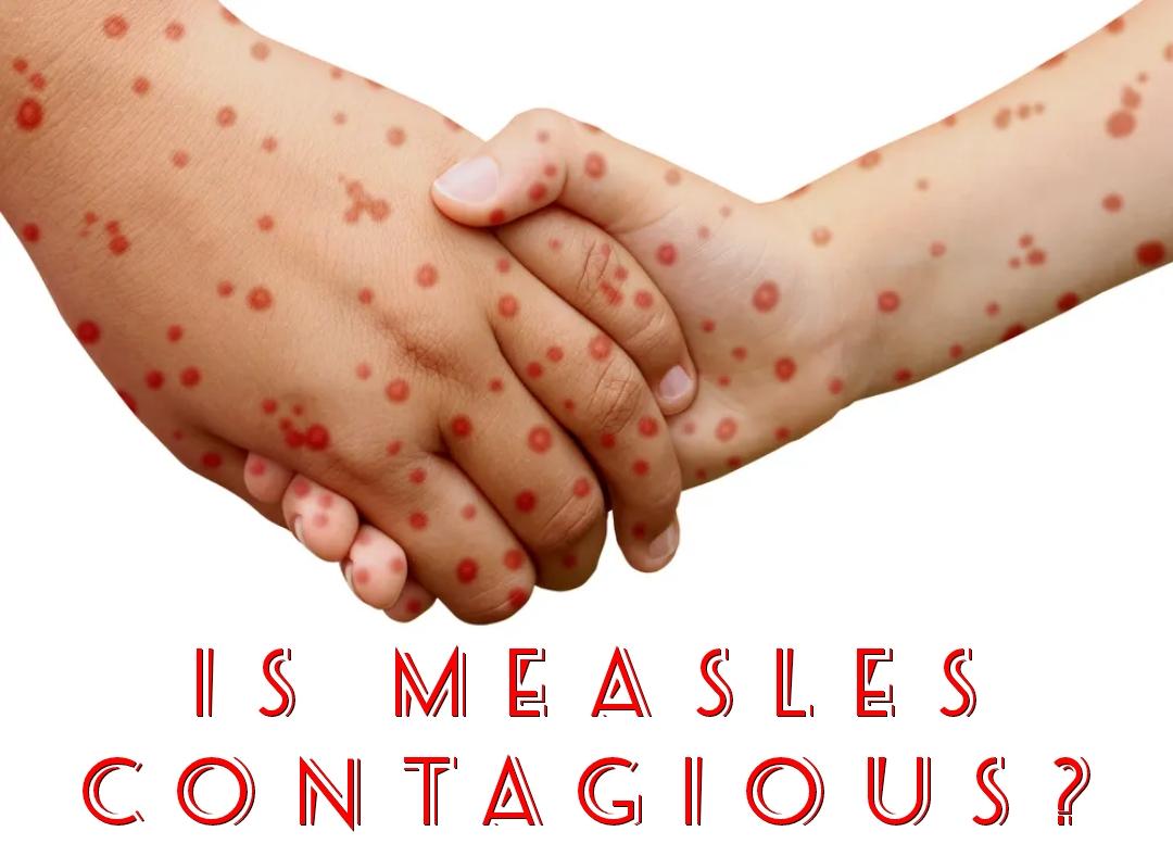 The Infectious Myth Busted Part 4: Is Measles Contagious?