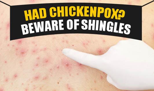 Chickenpox & Shingles: A Confusing Tale About the Same Disease Caused by the Same “Virus” Yet Given Different Names